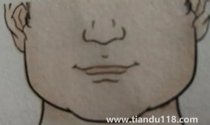 人中上的痣能去掉嗎（男人人中長(zhǎng)痣好不好）